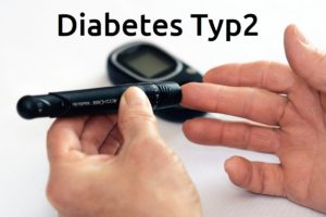 Diabetes Typ 2 - Ursachen, Risikofaktoren, Diagnose, Behandlung und Prävention