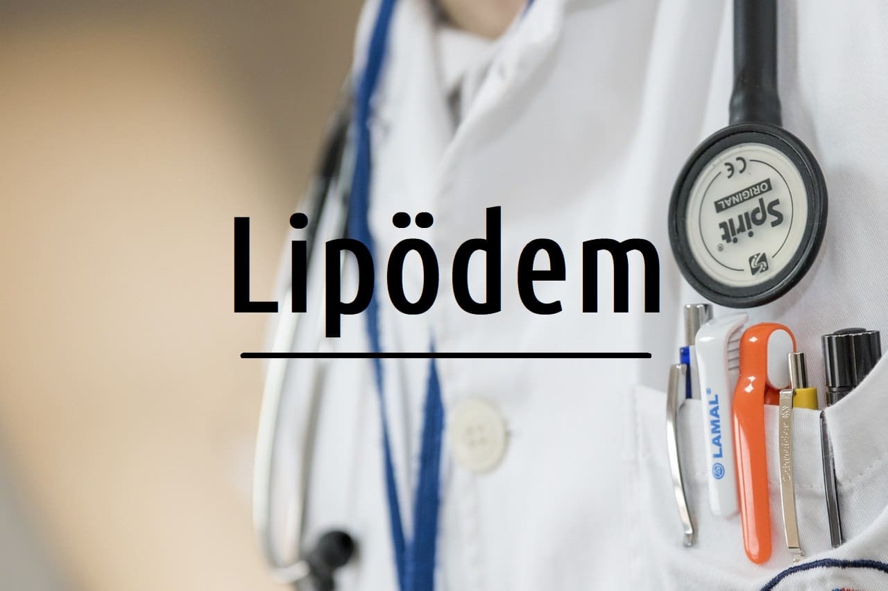 Lipödem - Symptome Ursachen und Behandlung