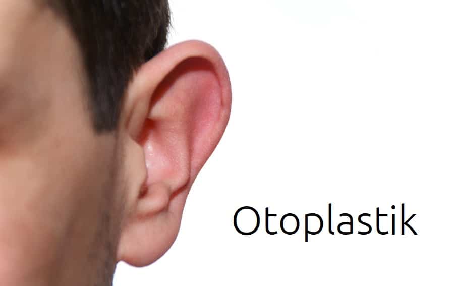 Ohrchirurgie (Otoplastik) – Ohren anlegen bei Segelohren