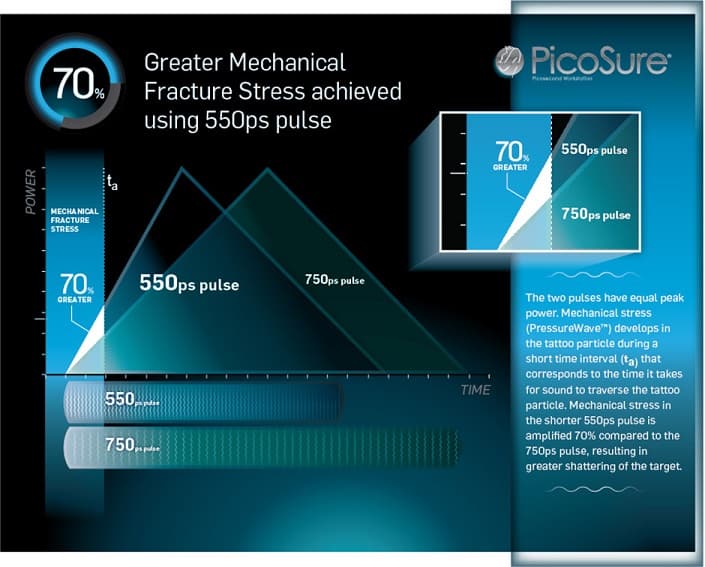 PicoSure_Boost_tattoo_removal