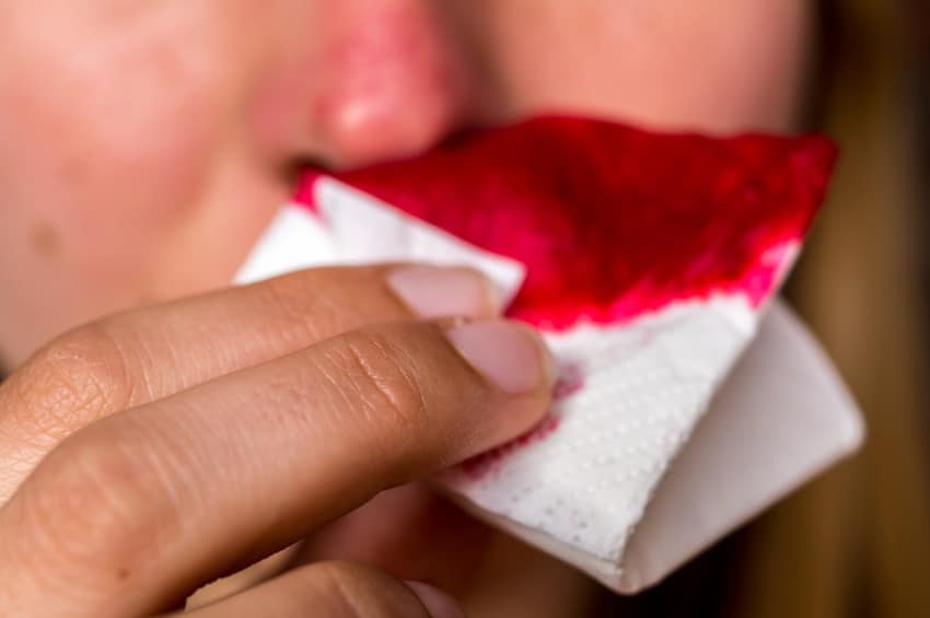 Nasenbluten – Warum blute ich, wenn ich mir die Nase putze?