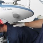 artas_haartransplantation_fue_roboter-1