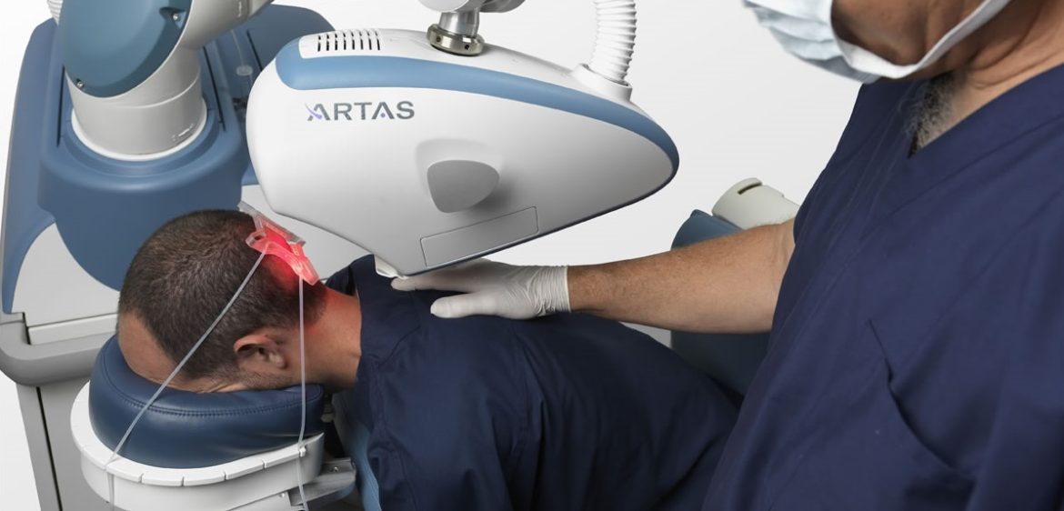 artas_haartransplantation_fue_roboter-1