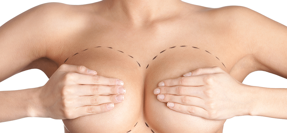 Was genau ist eine Bruststraffung? – FAQ
