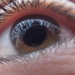 Wimpern-Ausfall-Ursachen_behandlung-madesis-Madarosis