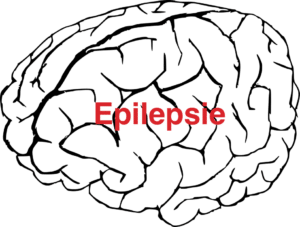 was_ist_epilepsie