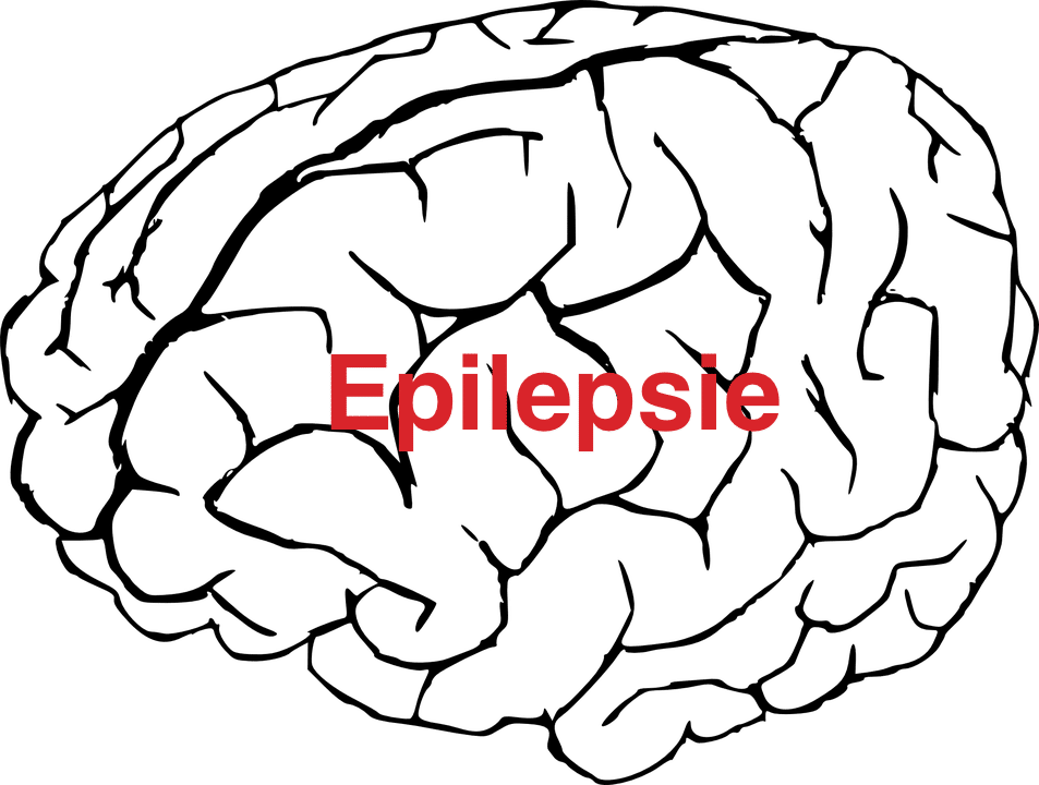 was_ist_epilepsie