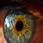 Femto-Lasik - Die beste Augenlaser Technologie