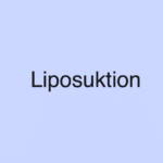 Liposuktion - Verfahren, Ablauf, Operation, Risiken einer Fettabsaugung
