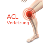 Verletzungen des vorderen Kreuzbandes (ACL)