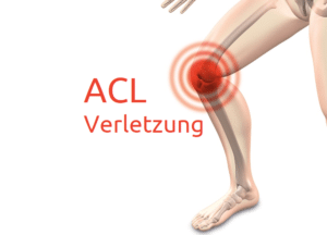Verletzungen des vorderen Kreuzbandes (ACL)