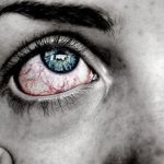 Bindehautentzuendung-Ursachen-Typen-Behandlung