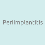 Periimplantitis-Ursachen-Behandlung-Risiken-Diagnose