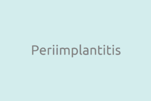 Periimplantitis-Ursachen-Behandlung-Risiken-Diagnose
