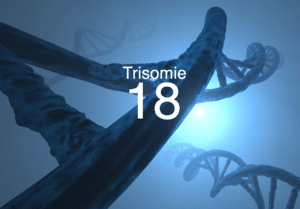 Was ist Trisomie 18?