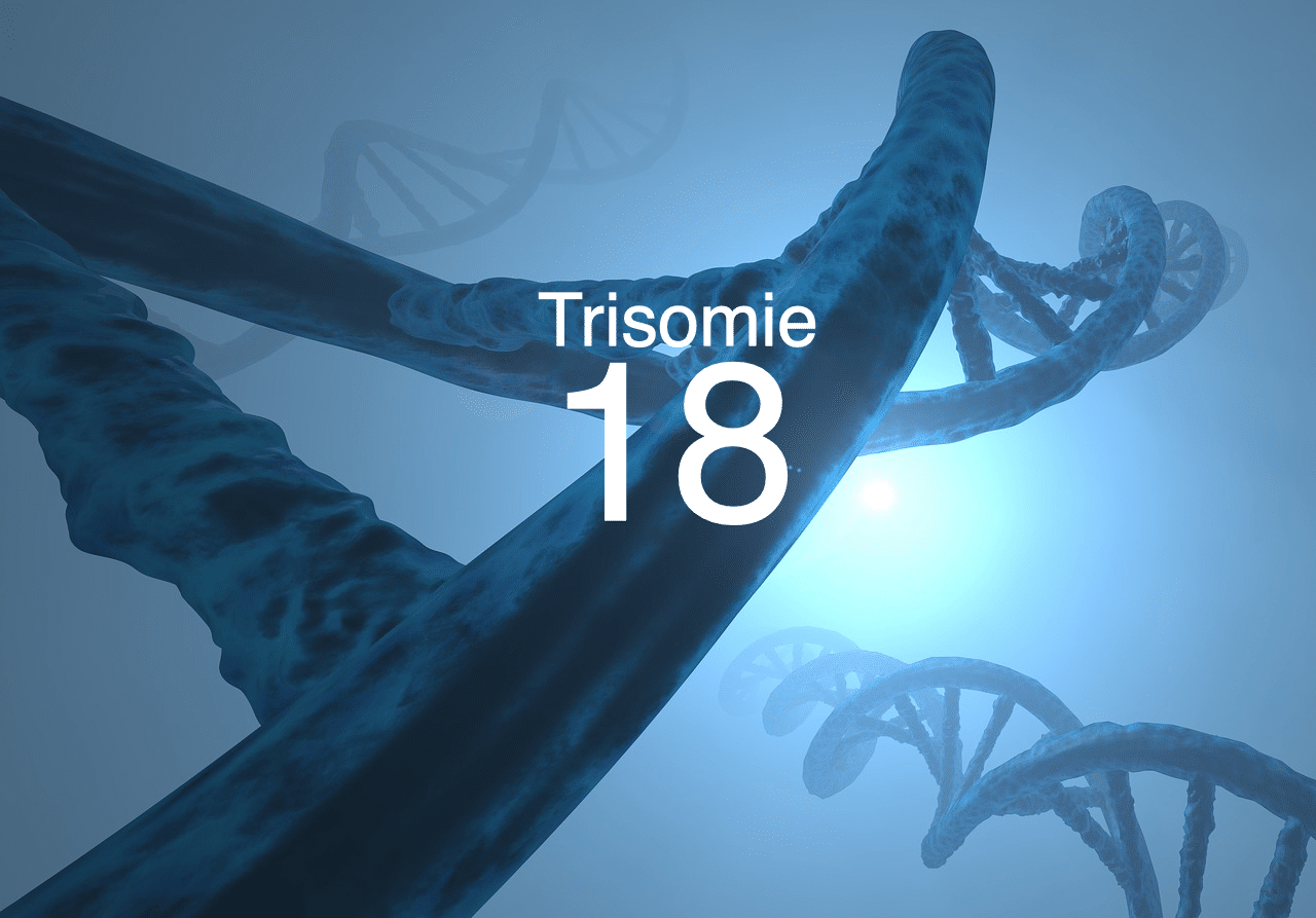 Was ist Trisomie 18?