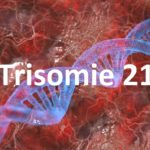 Trisomie 21 - Das Down-Syndrom
