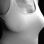 Brustvergrößerung mit Eigenfett - Fetttransfer