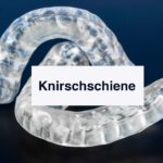 Okklusions Schienen gegen Zähneknirschen