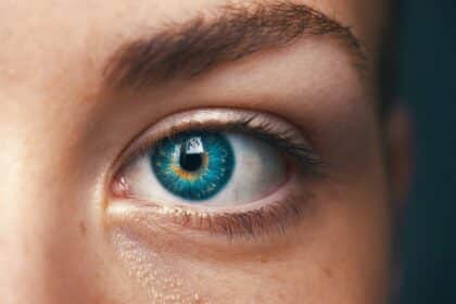 Blepharoplastik und Ptosis - Ursachen und Behandlung