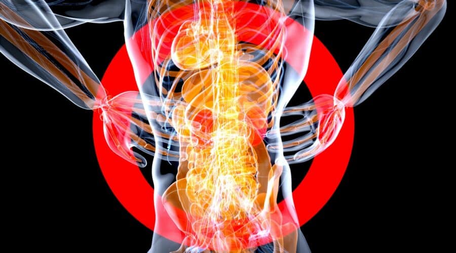 Zollinger-Ellison-Syndrom: Symptome, Ursachen & Behandlung