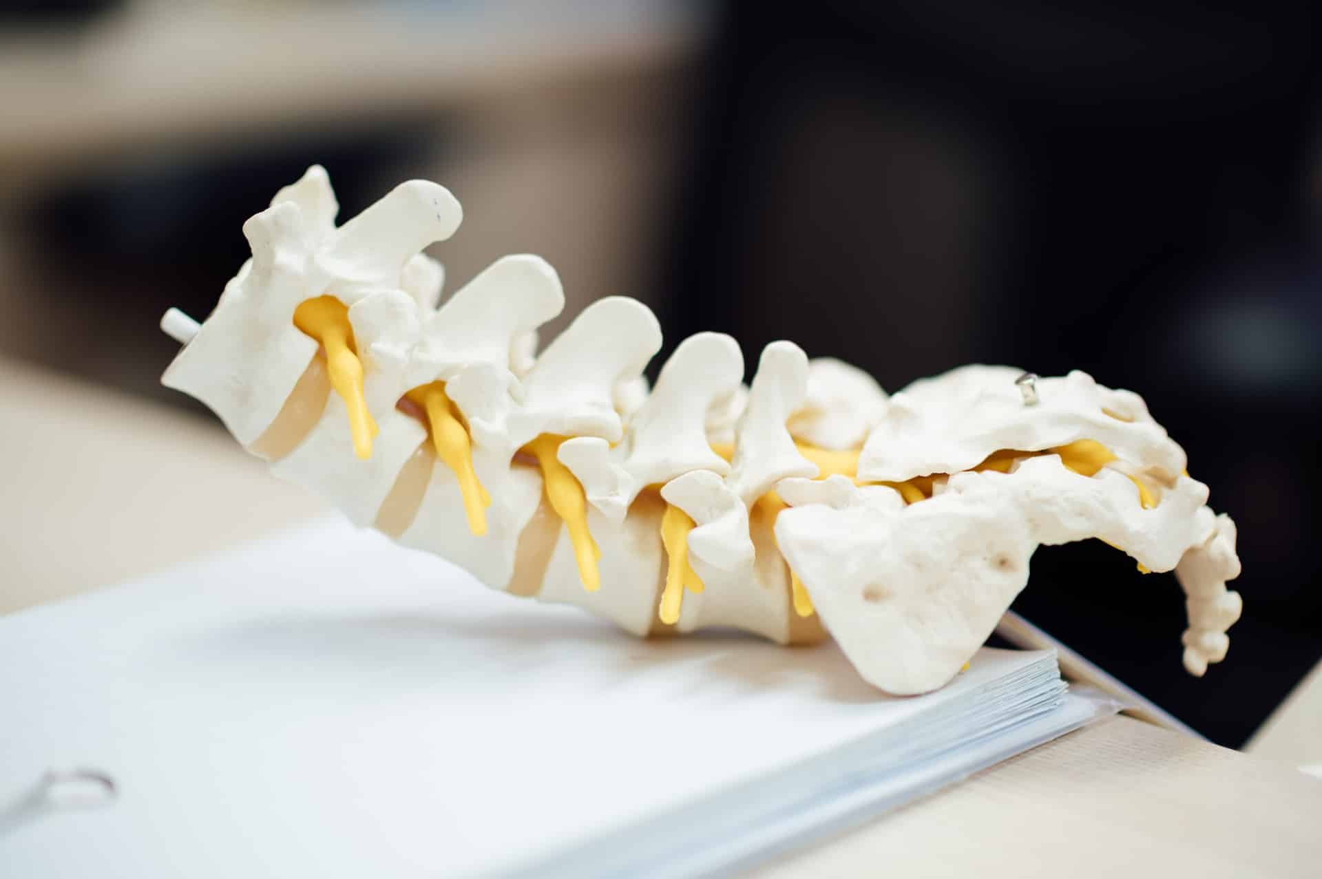 Insgesamt ist die Genesung von einem angebrochenen Wirbel ein komplexer Prozess, der Zeit und Geduld erfordert. » Medizin - Fitness - Ernährung Insgesamt ist die Genesung von einem angebrochenen Wirbel ein komplexer Prozess, der Zeit und Geduld erfordert.