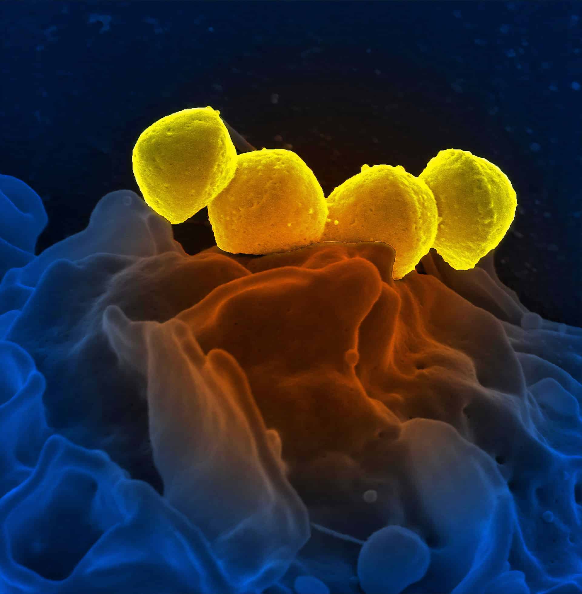 Bodenorganismen (SBOs) unterstützen die Darmgesundheit und die Immunantwort Bodenorganismen (SBOs) unterstützen die Darmgesundheit und die Immunantwort