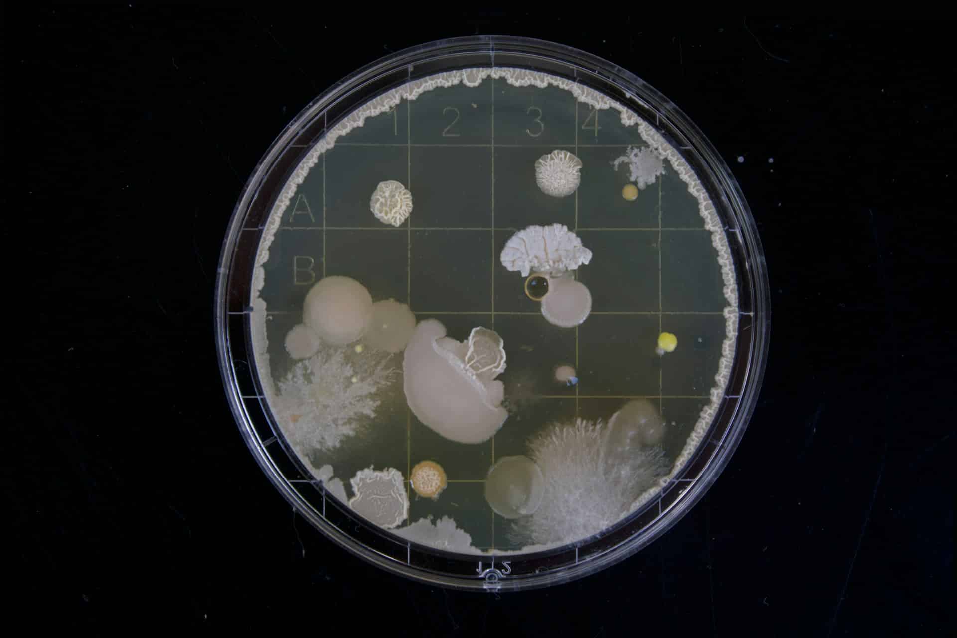 Welche Bakterienarten verursachen Wundinfektionen?