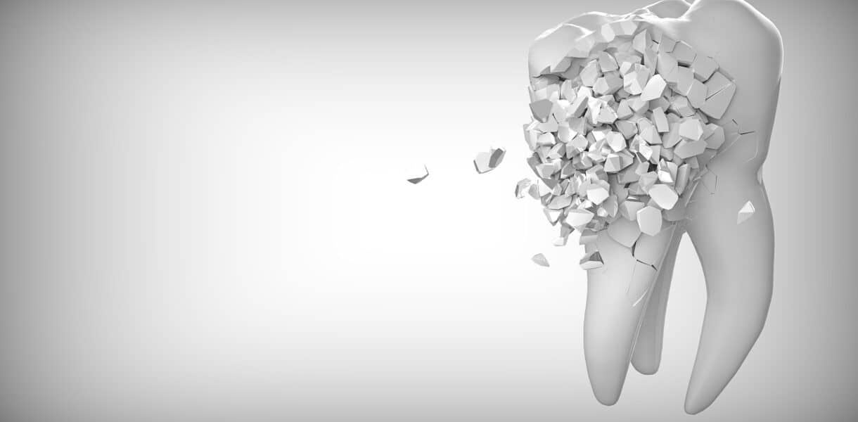 Anzeichen dafür, dass ein Zahn versteckt ist – sollte er gezogen werden?