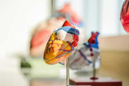 Broken-Heart-Syndrom, auch bekannt als Stress-Kardiomyopathie oder Takotsubo-Syndrom