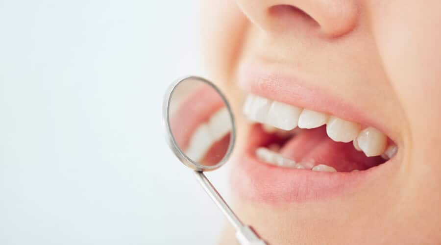 Ursachen und Behandlung von transparenten Zähnen