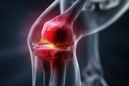 Knieoperation – Ablauf, Methoden und Nachbehandlung